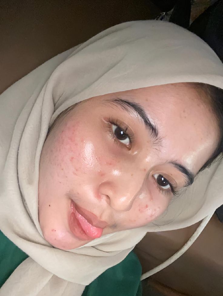 SMP Viral Hijab Abg 2025 Terbaru Indo Yang Masih Gurih Dan Kriuk Jadi Pusat Icikiwir Global Trending Top New